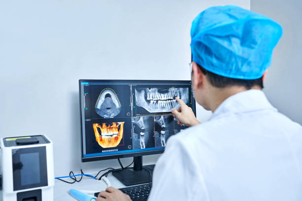 Best Emergency Root Canal Treatment in Soperton, GA